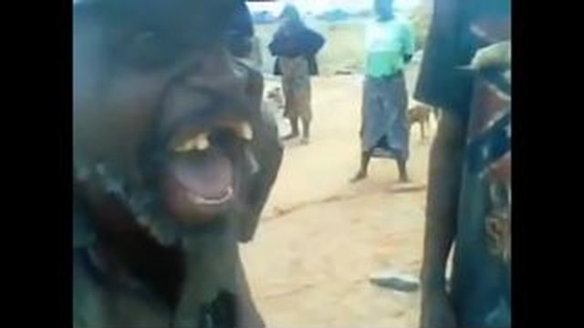toothless man laughing